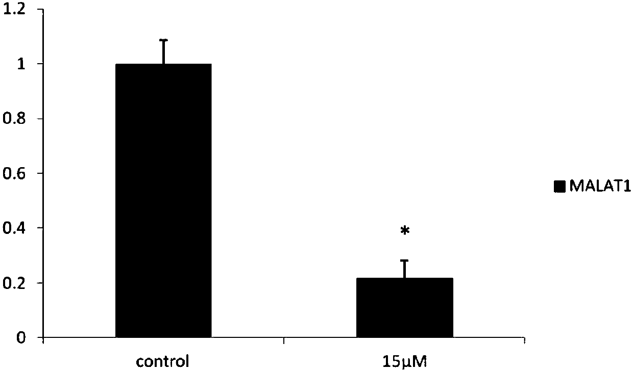 Application of calycosin derivative in preparation of drug for treating ER feminine breast cancer