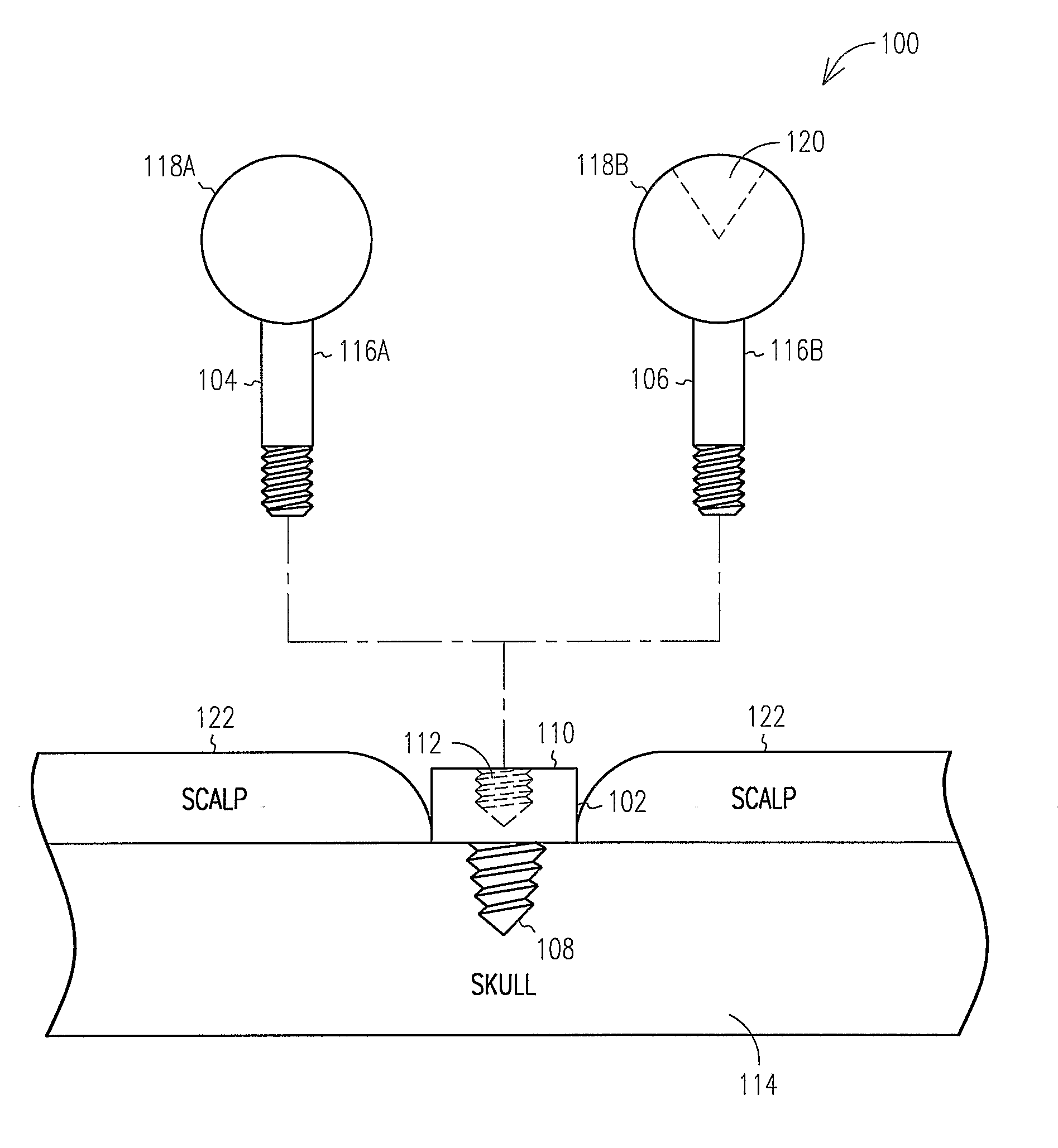 Fiducial Marker and Protective Cap