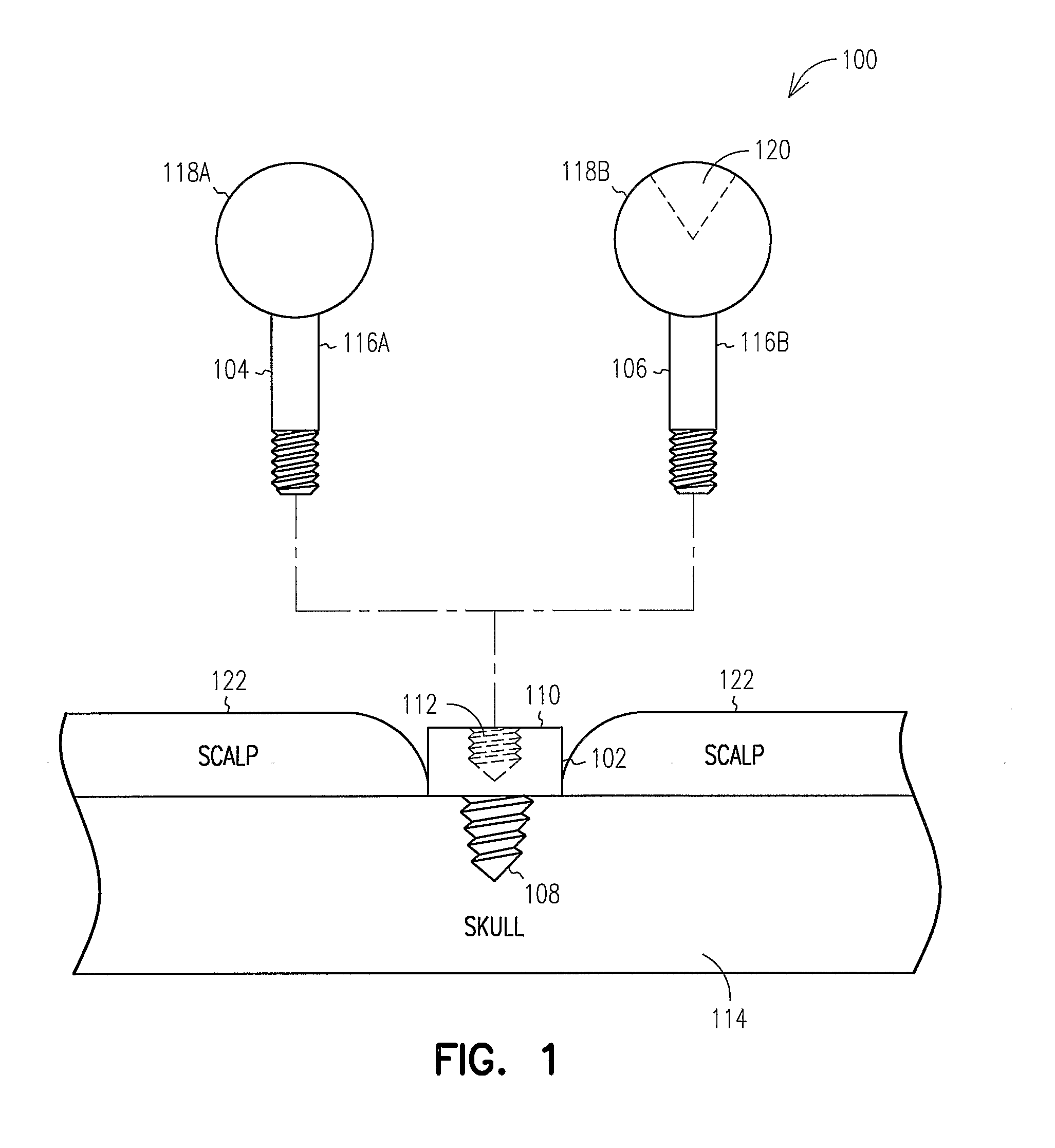 Fiducial Marker and Protective Cap