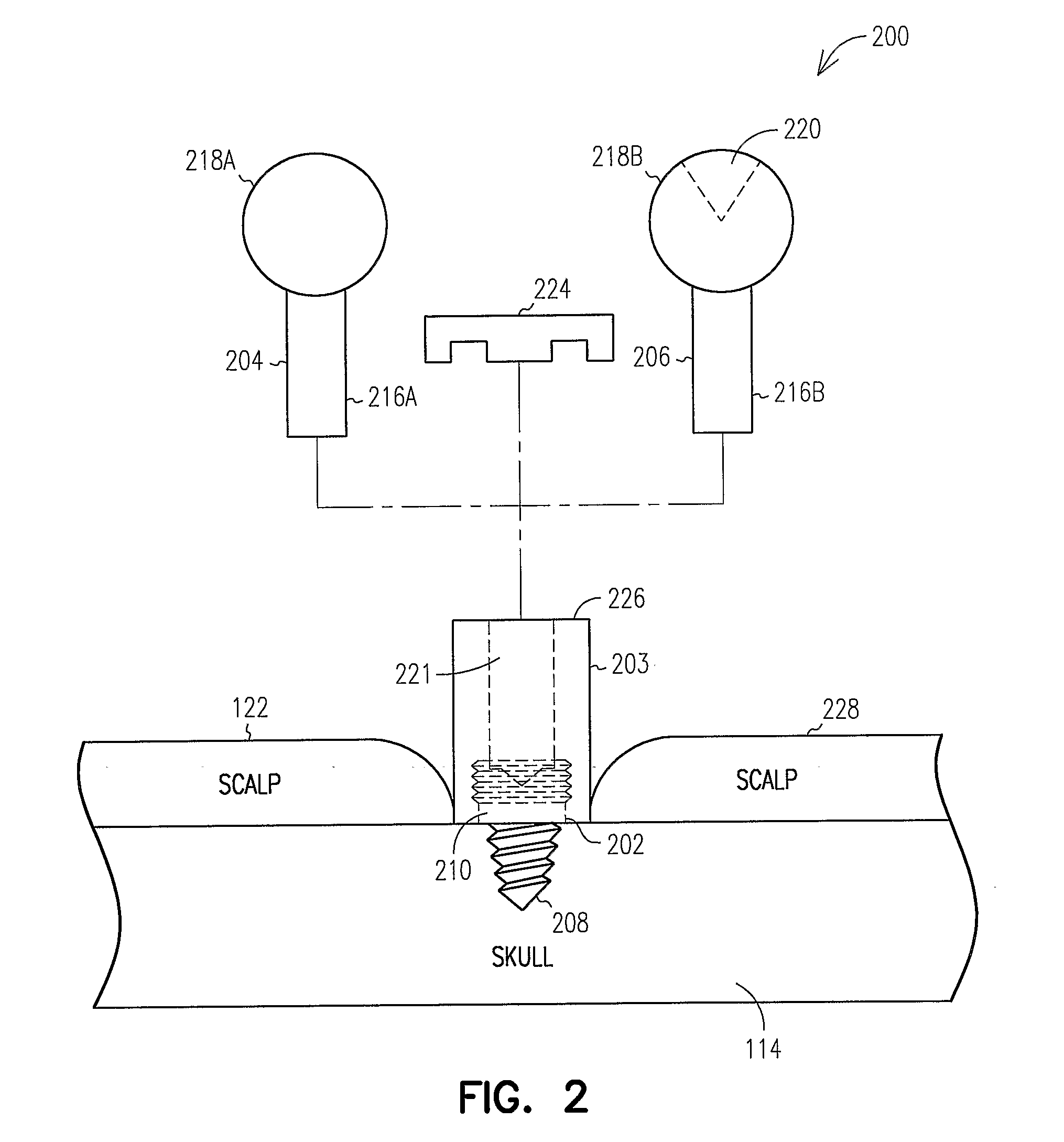 Fiducial Marker and Protective Cap