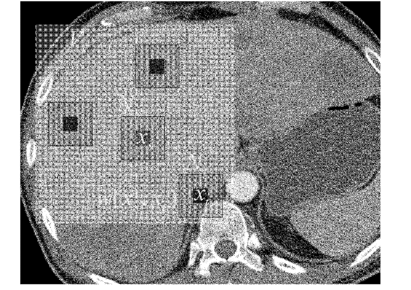 Markov random field model and non-local prior based image registration method