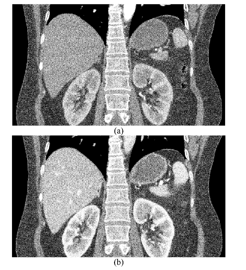 Markov random field model and non-local prior based image registration method