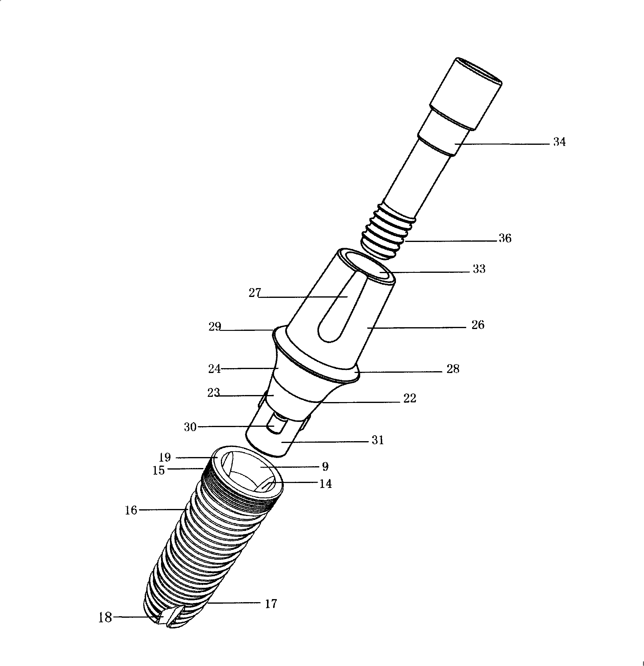 Pipe sleeve anti-rotary dentistry implant