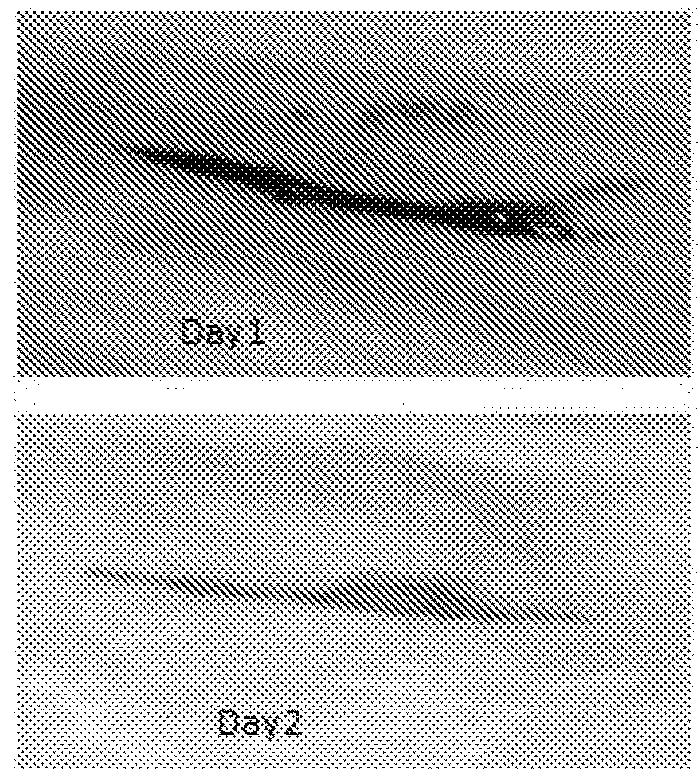 A novel pharmaceutical wound healing composition