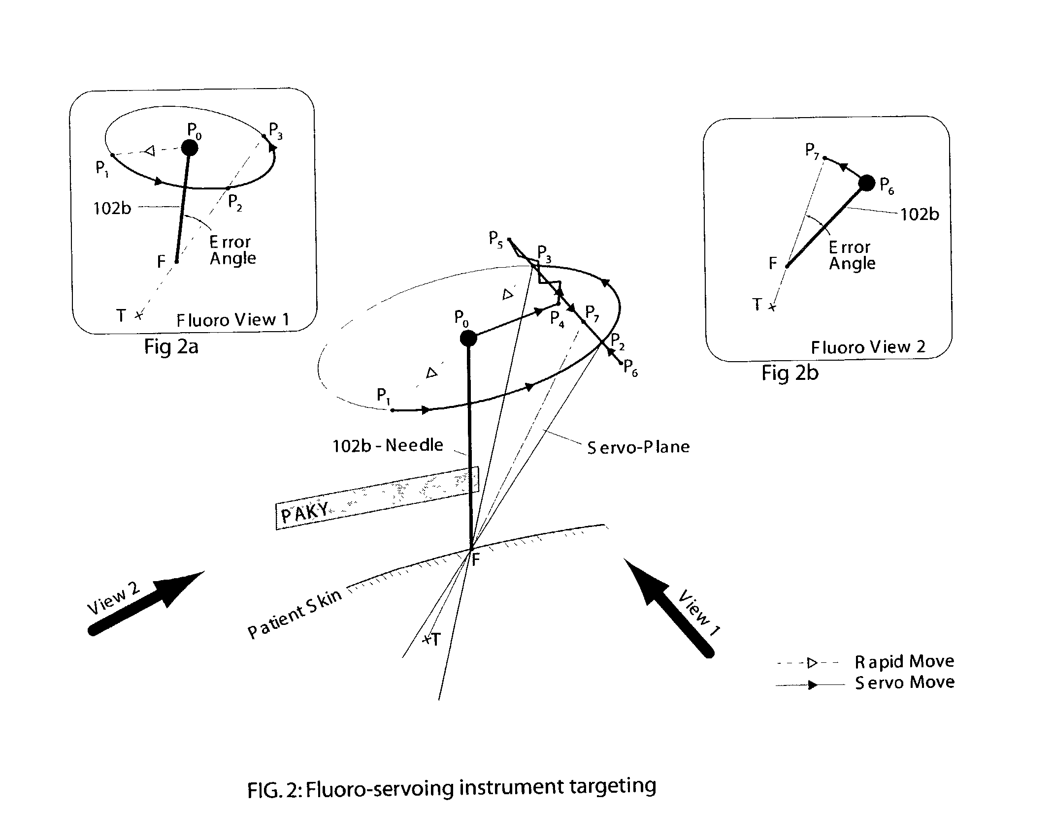 System and method for robot targeting under fluoroscopy based on image servoing