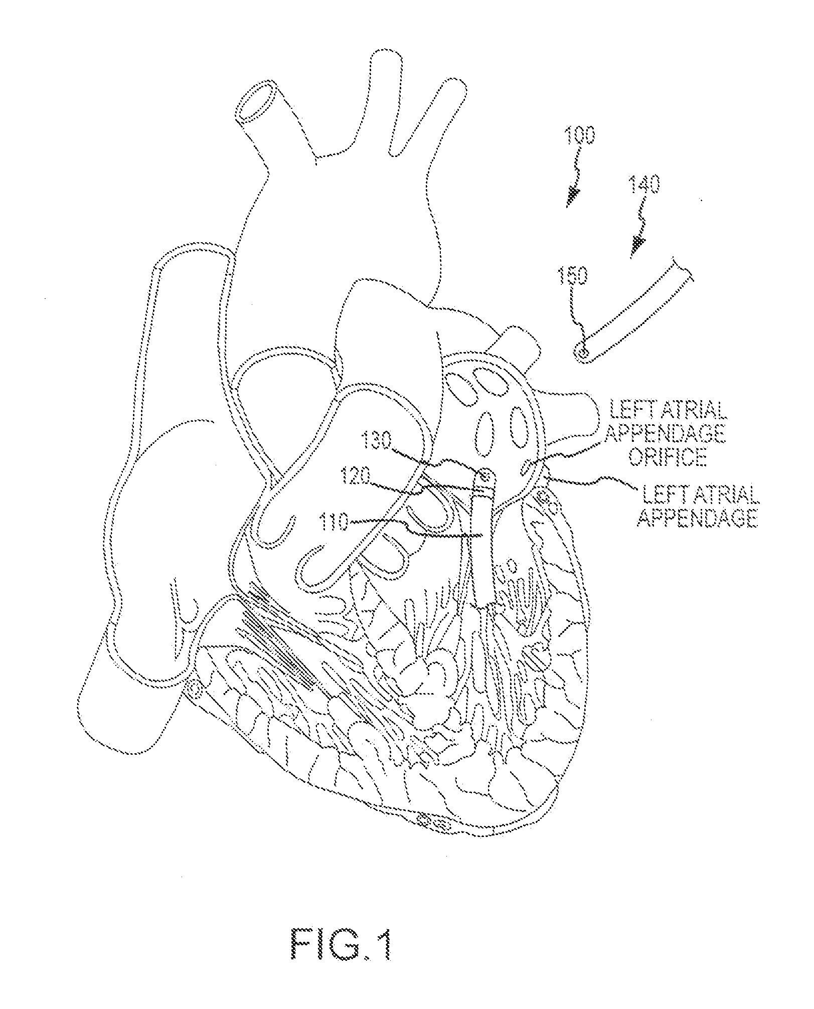 Magnetic navigation systems and methods