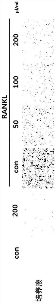 Composition for improving, preventing, or treating bone diseases or metabolic diseases, including novel lactobacillus sakei cvl-001 strain and culture medium thereof