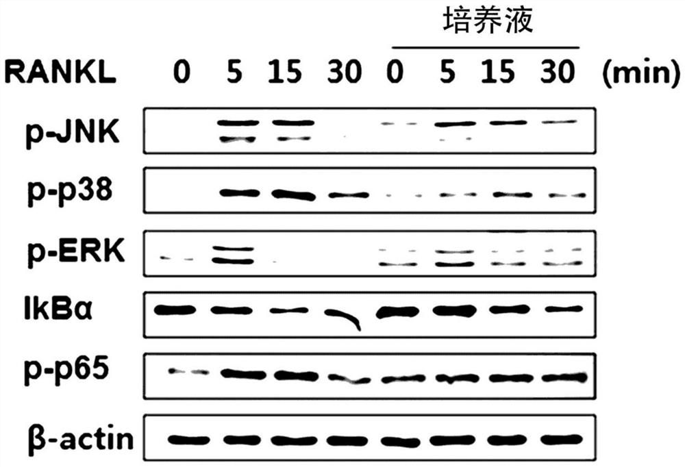 Composition for improving, preventing, or treating bone diseases or metabolic diseases, including novel lactobacillus sakei cvl-001 strain and culture medium thereof