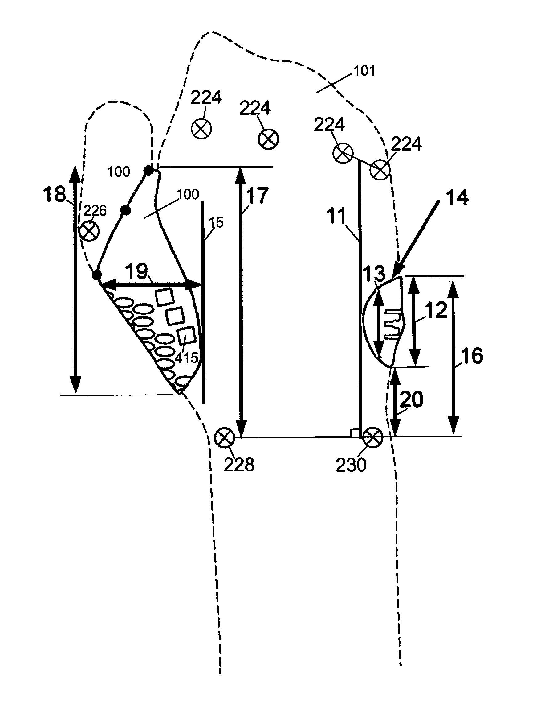 Conformal hand brace