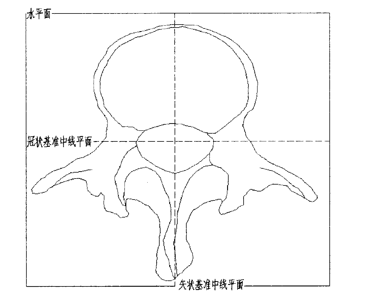 Personalized lumbar internal fixation auxiliary device and manufacturing method thereof