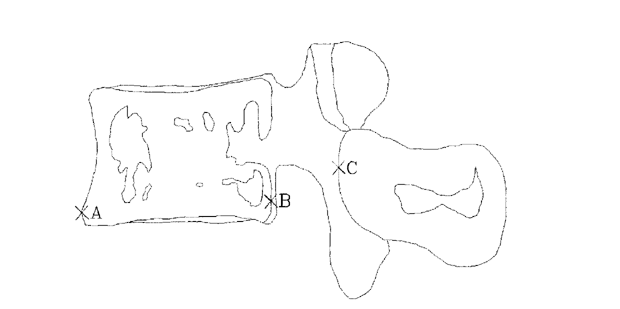 Personalized lumbar internal fixation auxiliary device and manufacturing method thereof