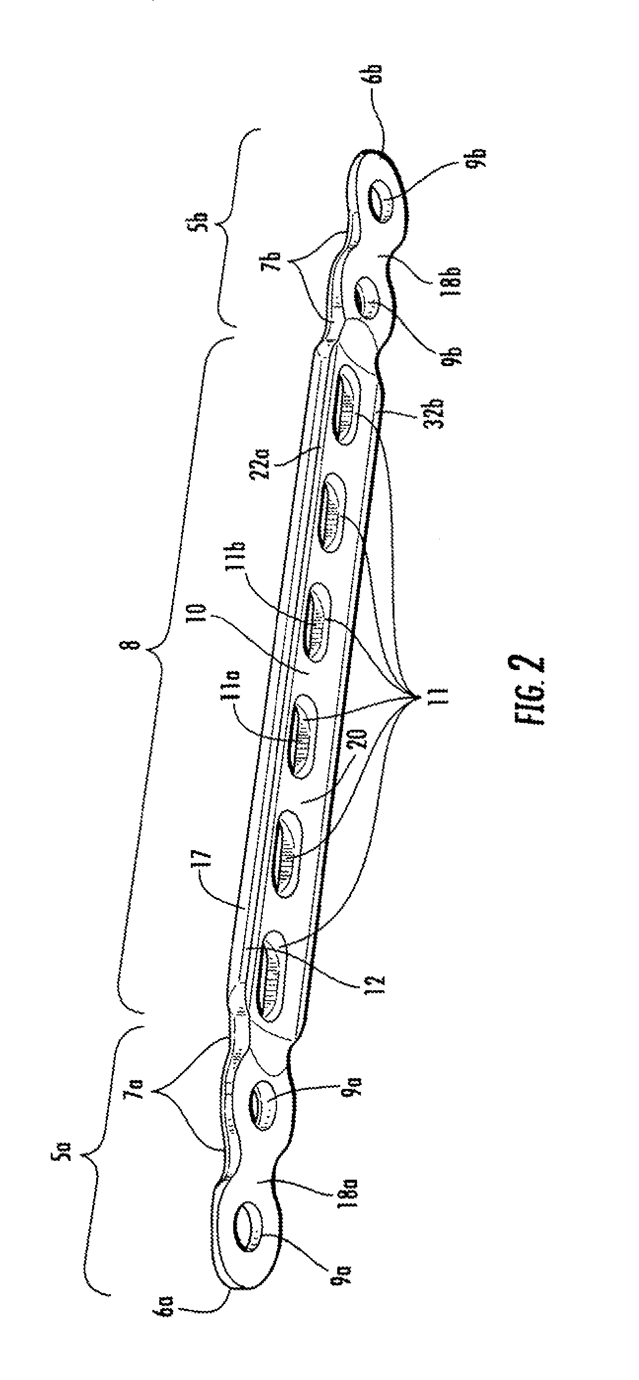 Clavicle plate and screws