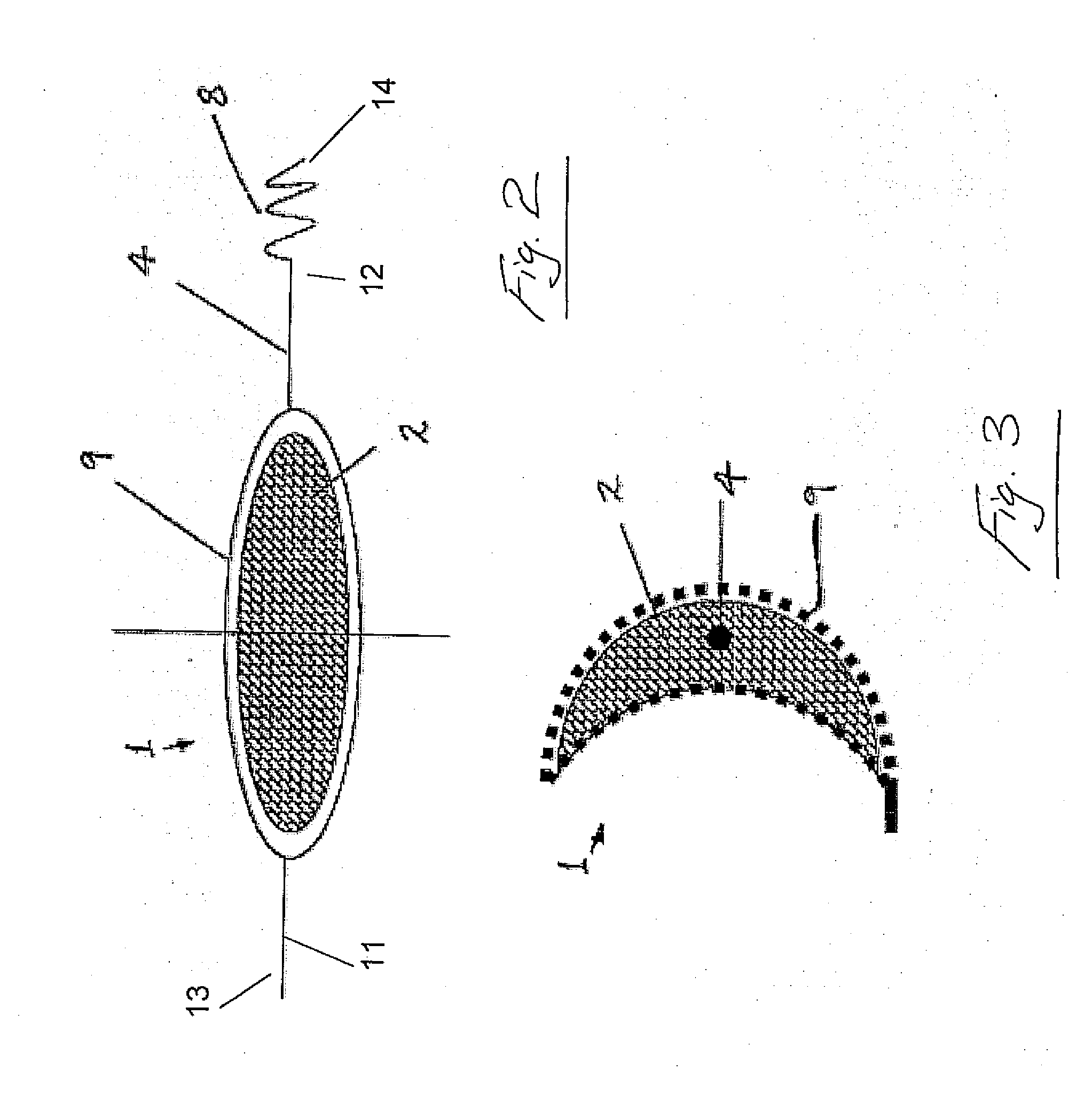 Medical device for use in treatment of a valve