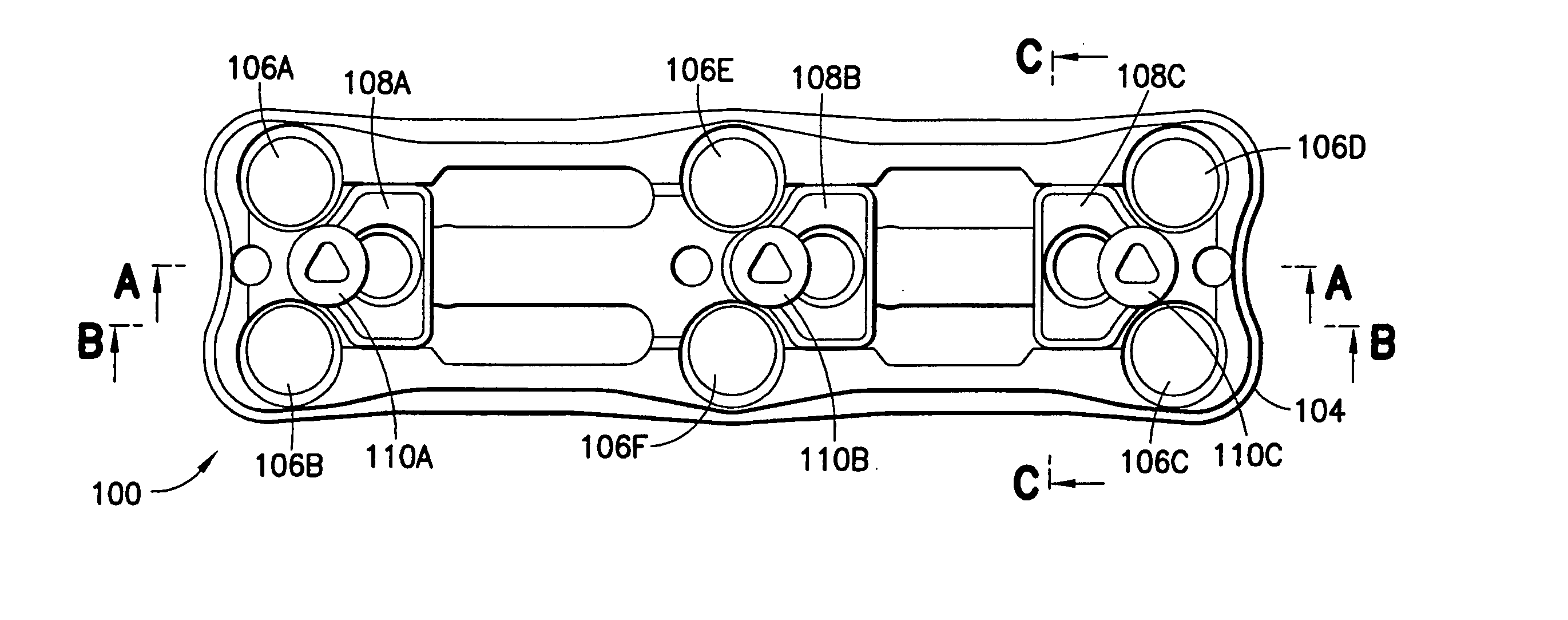 Anterior cervical plating system