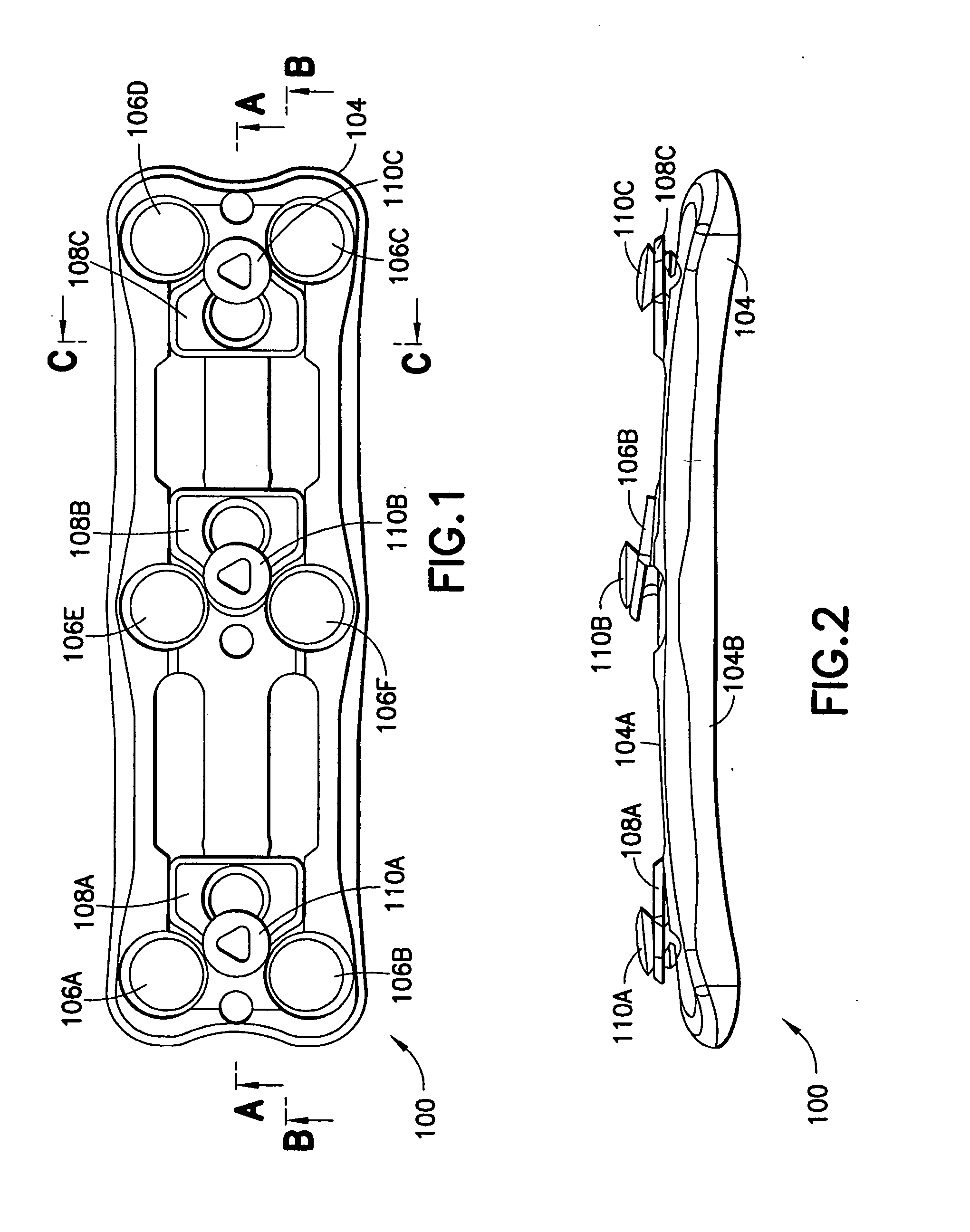 Anterior cervical plating system