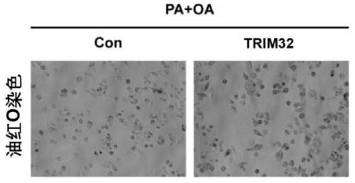 Application of e3 ubiquitin ligase trim32 in the preparation of drugs for treating fatty liver and related diseases