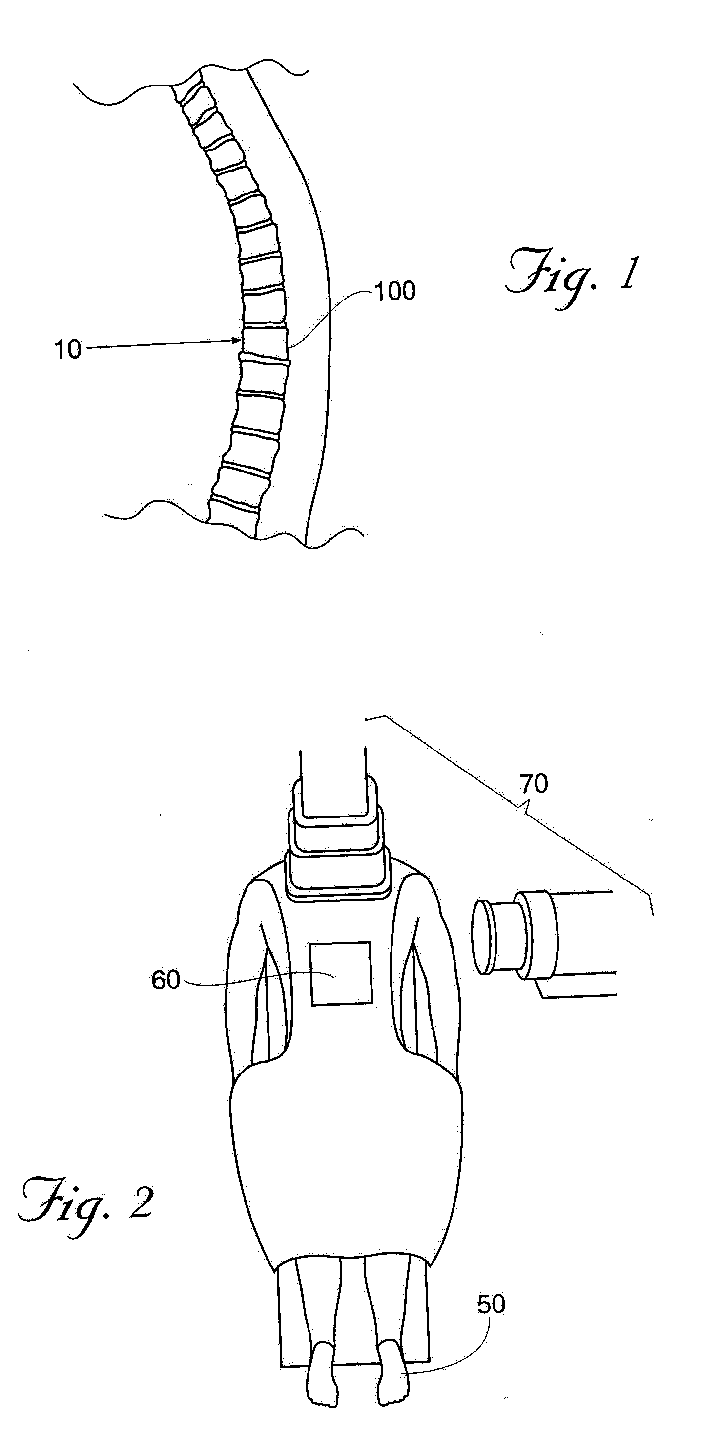 Methods and devices for treating fractured and/or diseased bone