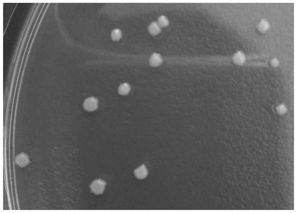 A biological fermentation product for preventing and treating colitis and its preparation method