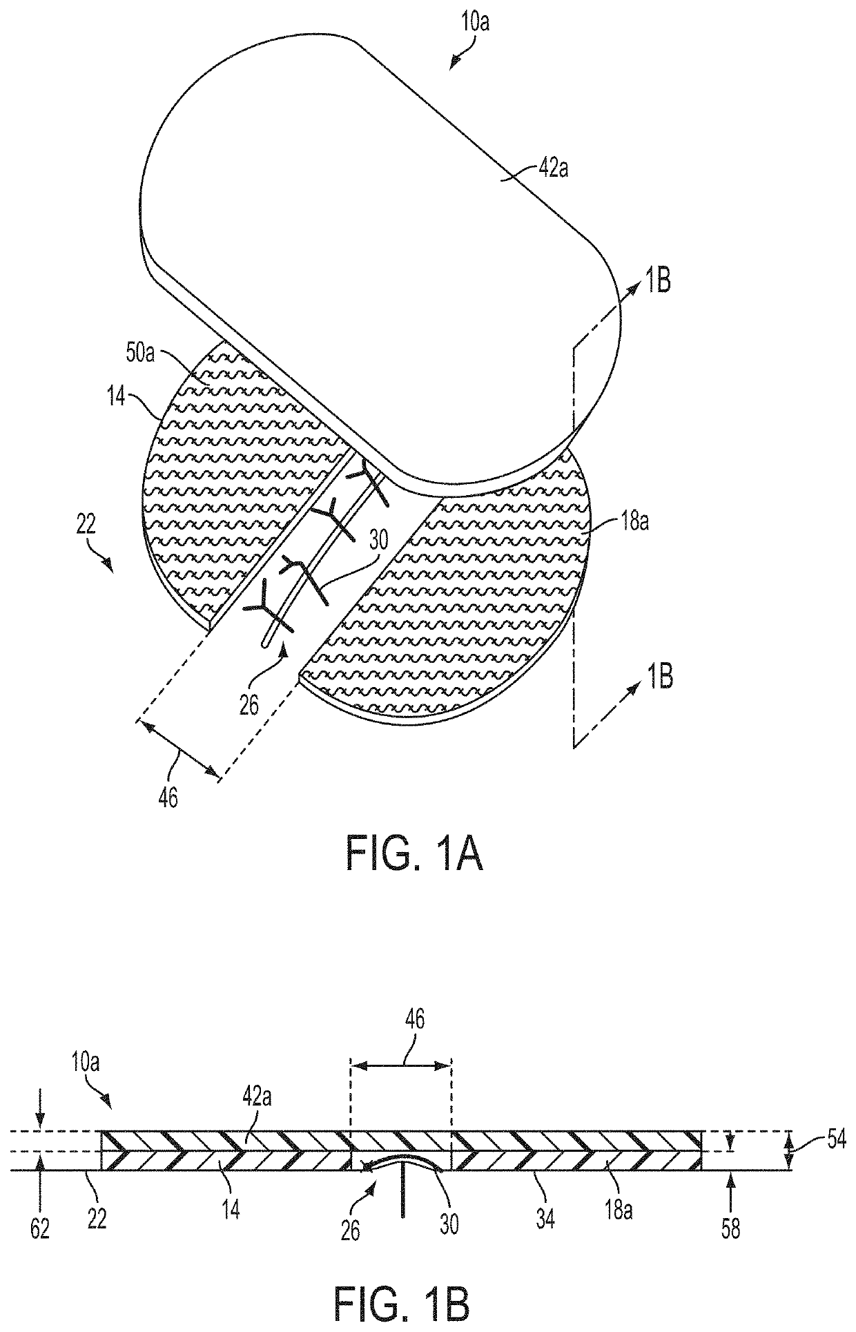 Apparatuses and methods for minimizing wound dehiscence, scar spread, and/or the like