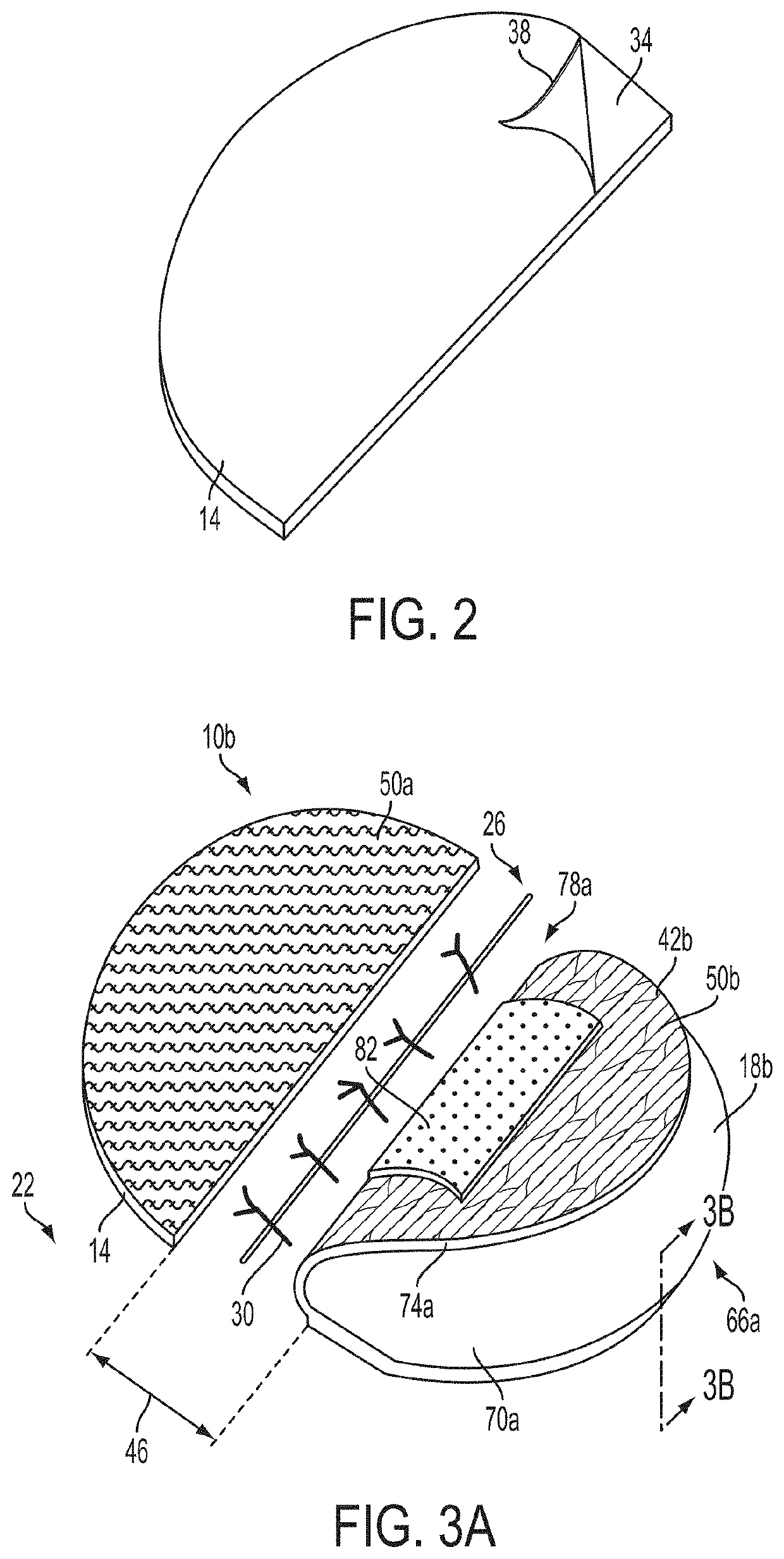 Apparatuses and methods for minimizing wound dehiscence, scar spread, and/or the like