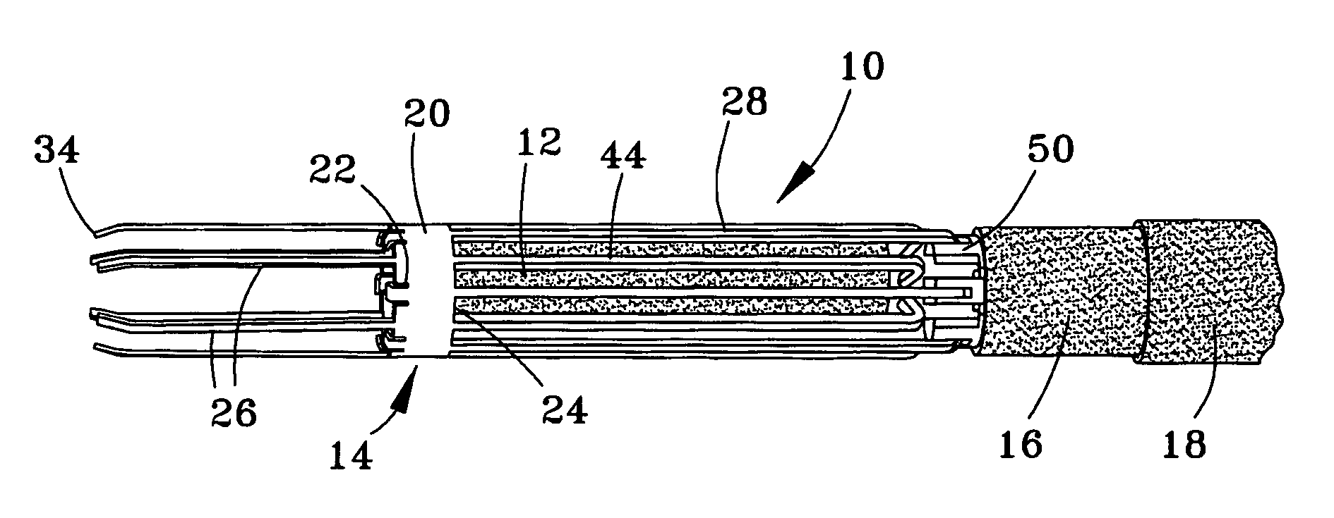 Delivery system, method, and anchor for medical implant placement