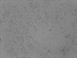 HELQ gene mRNA level in-situ hybridization detection kit, detection method and applications thereof