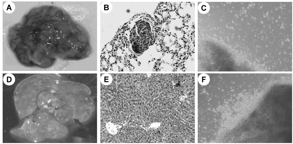 A pair of human stomach cancer cell lines having high metastasis towards livers and lungs and an establishing method thereof