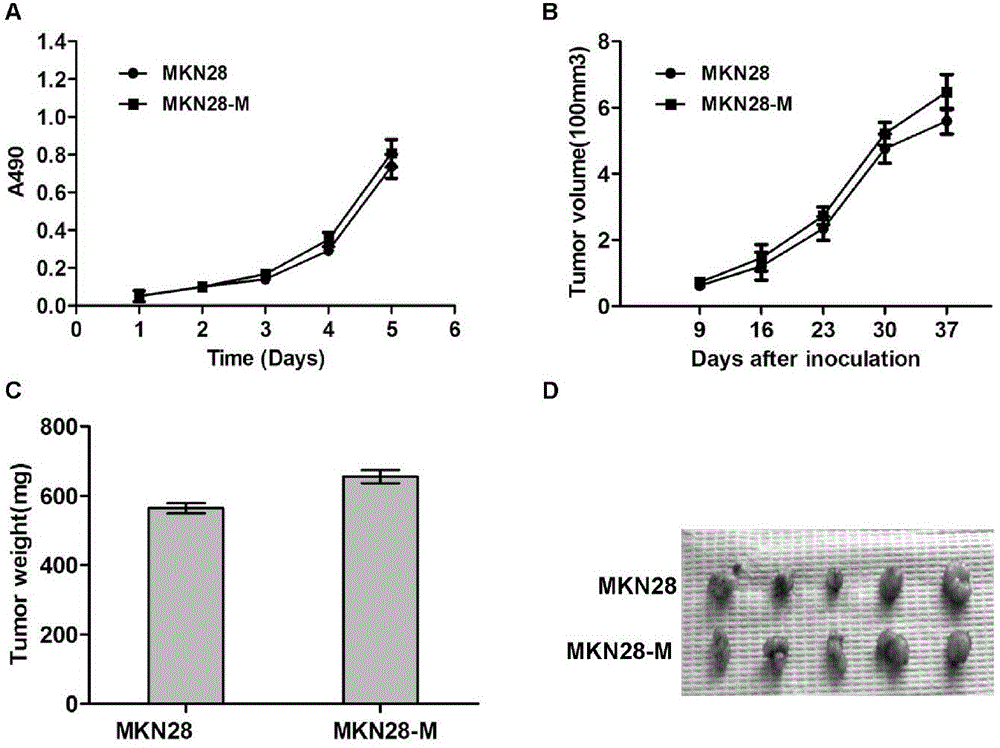 A pair of human stomach cancer cell lines having high metastasis towards livers and lungs and an establishing method thereof