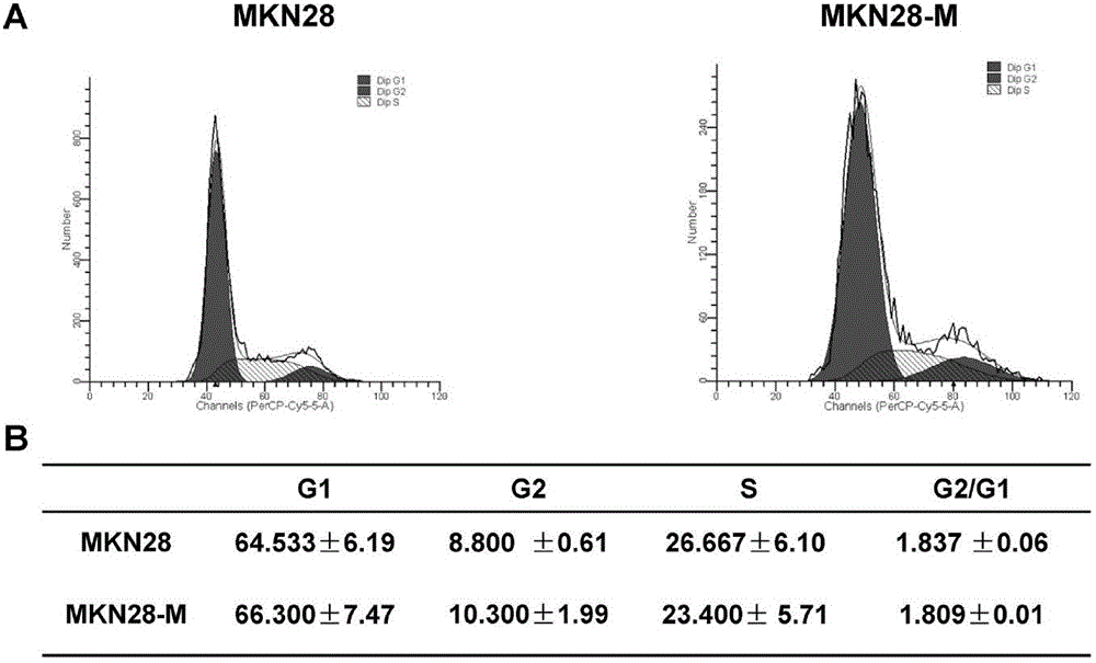 A pair of human stomach cancer cell lines having high metastasis towards livers and lungs and an establishing method thereof