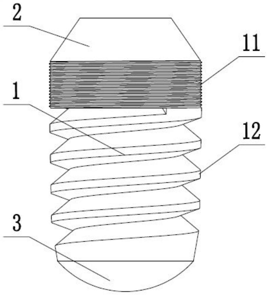 an oral implant