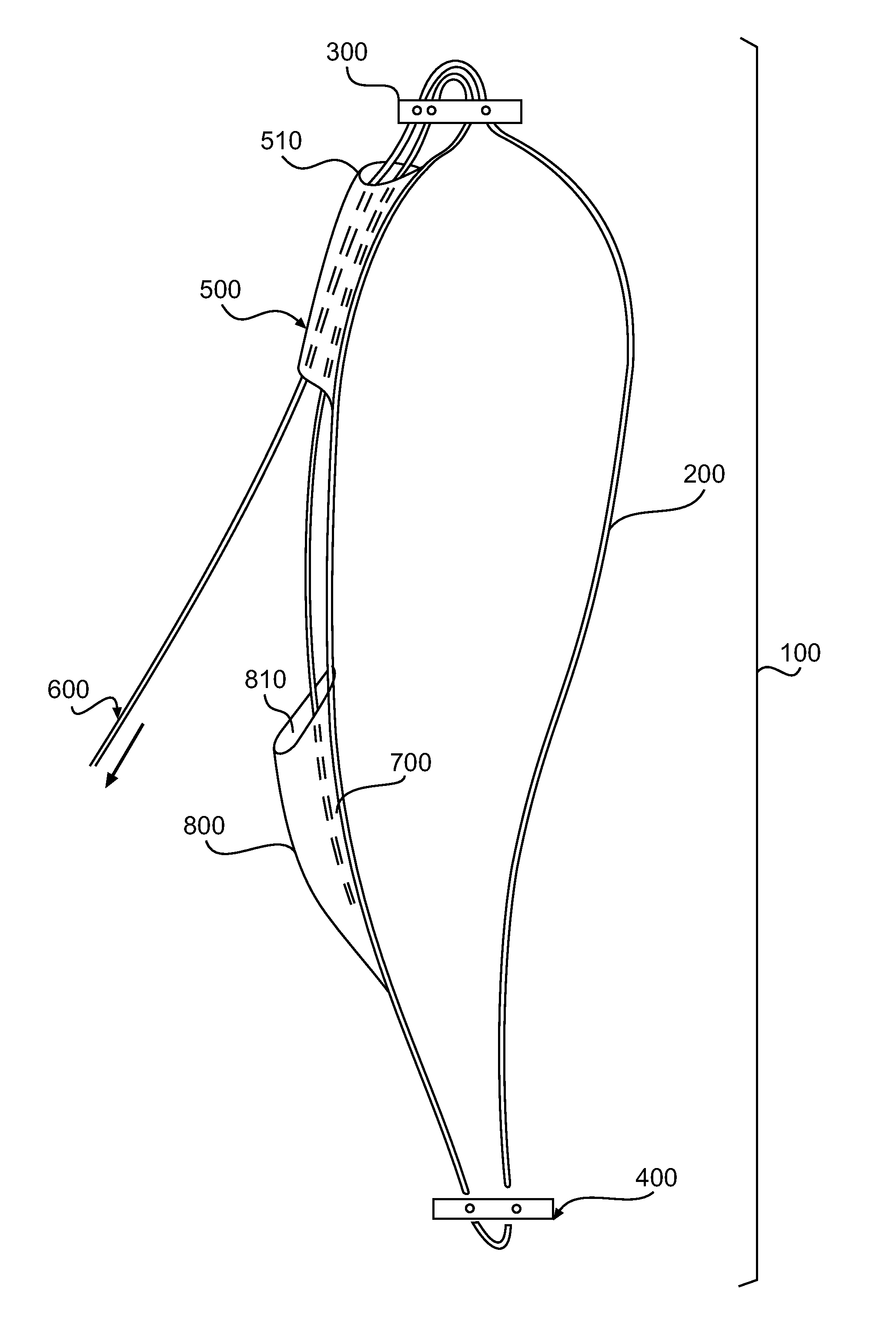 Adjustable Suture Lock Loop