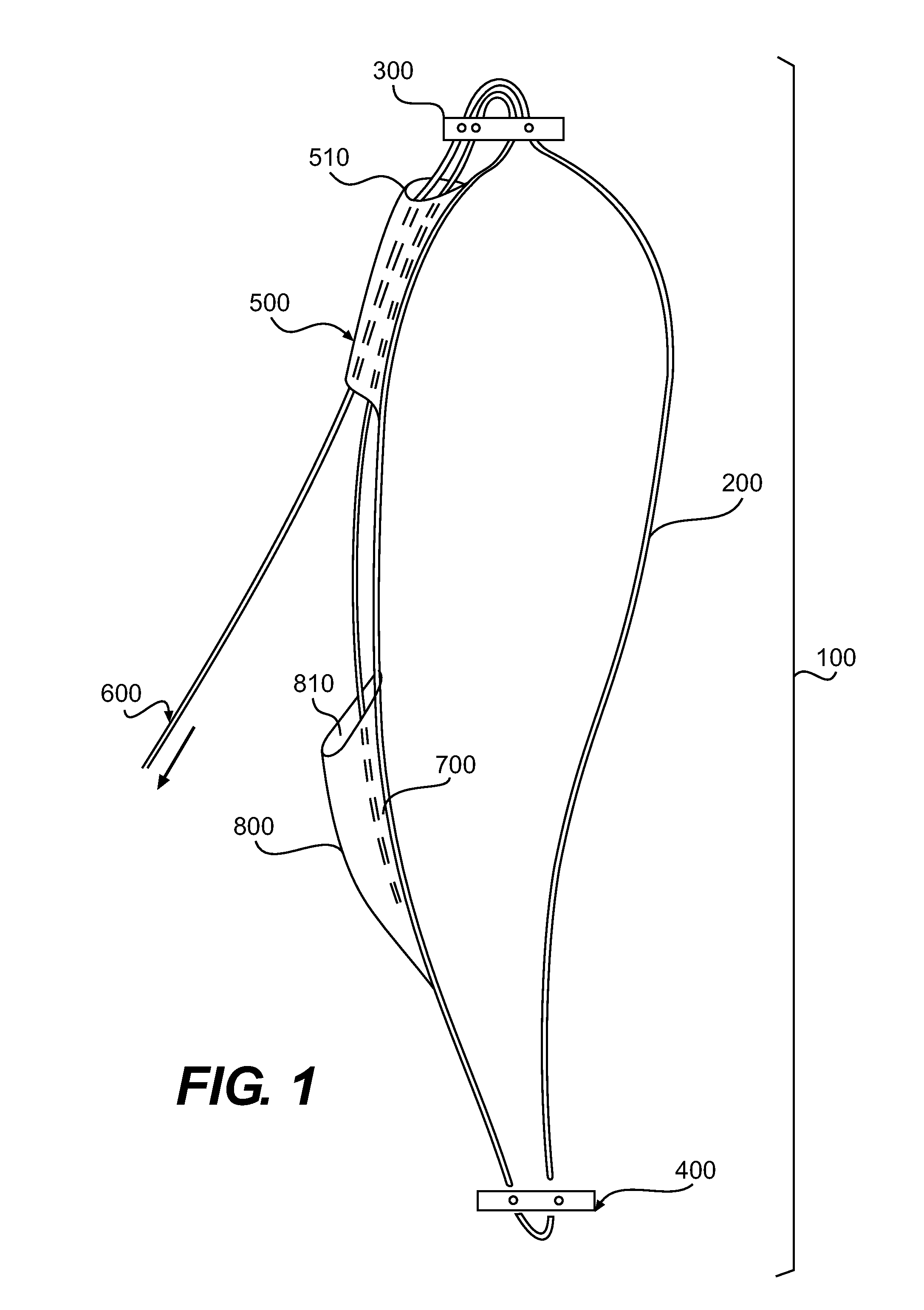 Adjustable Suture Lock Loop