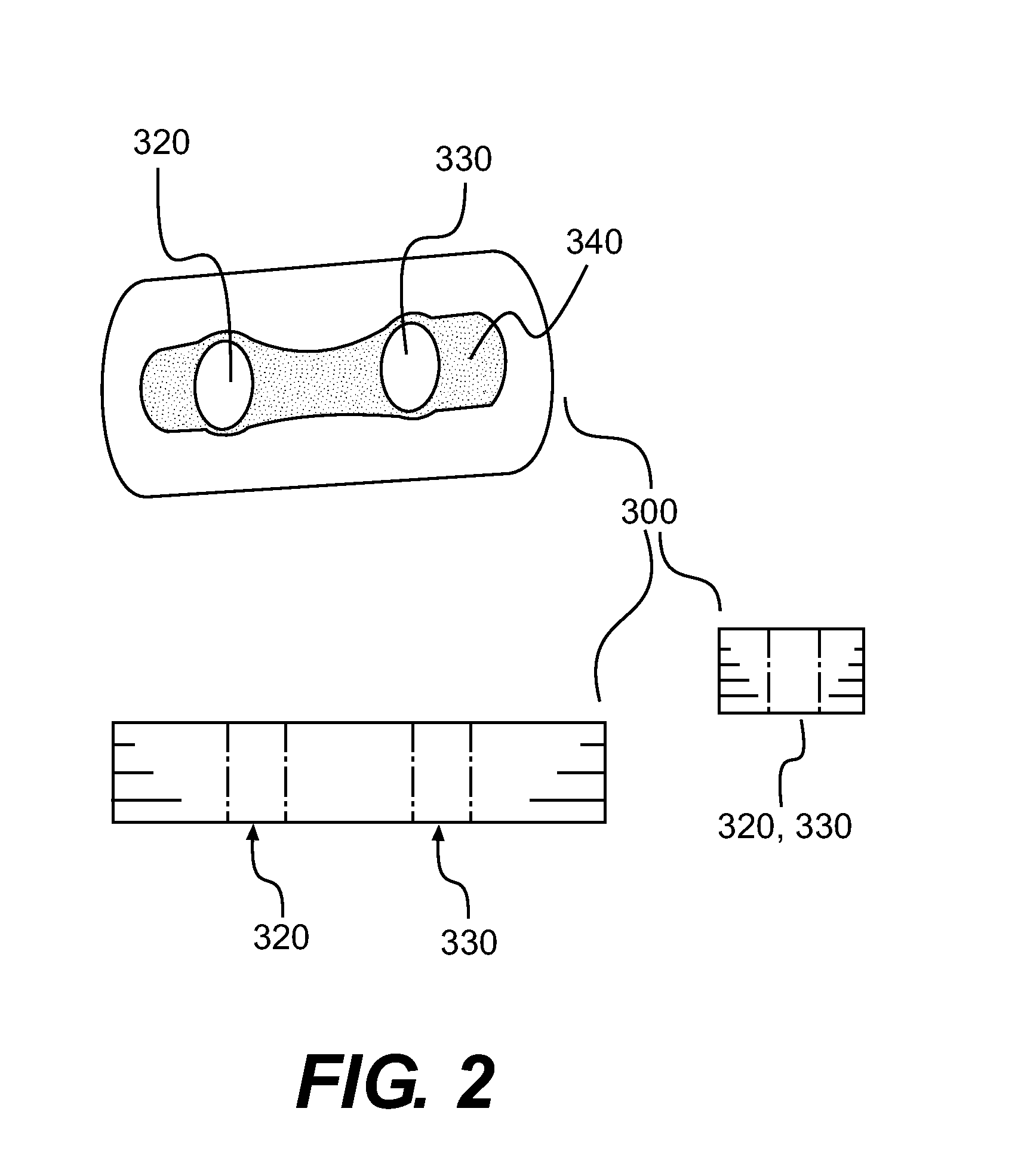 Adjustable Suture Lock Loop