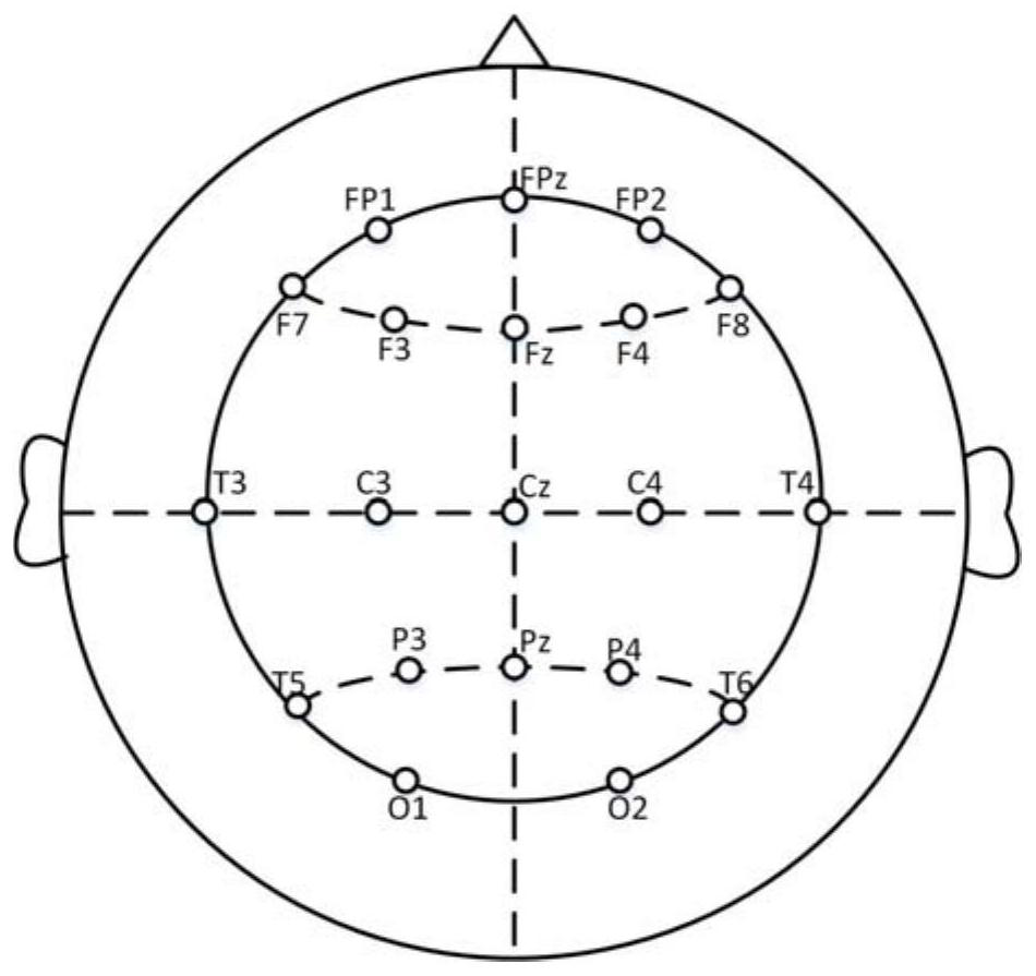 Method for intelligently detecting BECT spike waves based on multichannel electroencephalograms