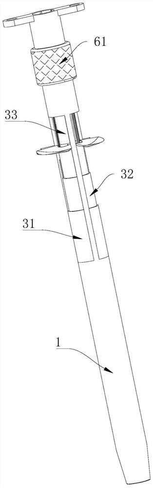 Ureteral stent imbedding auxiliary component