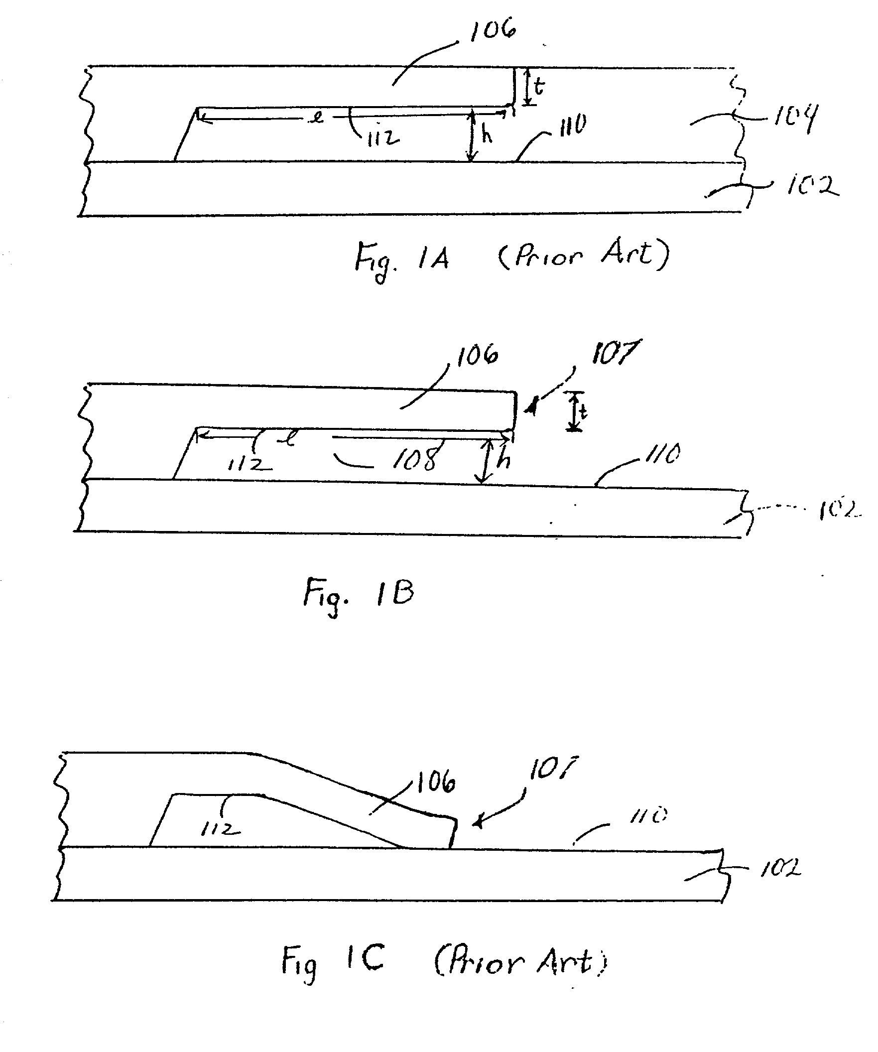 Dry etch release of MEMS structures