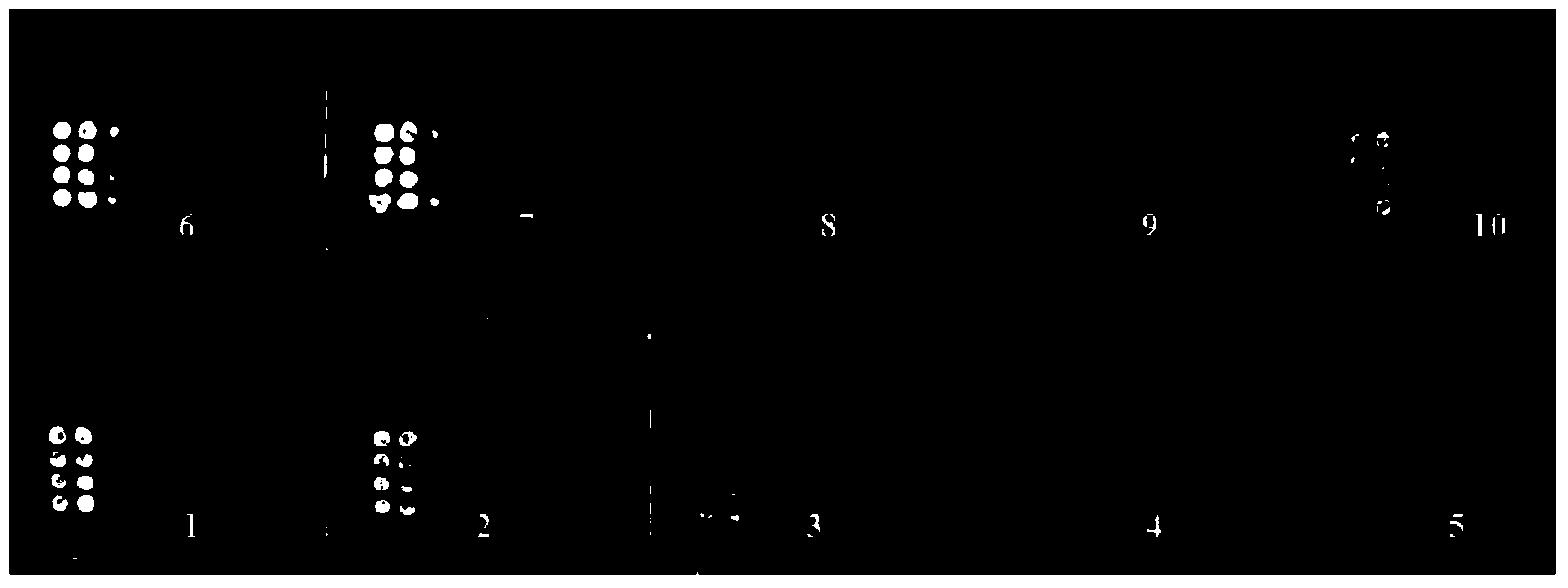 Method for measuring antigen protein in serum by chemiluminescence protein chips and kit