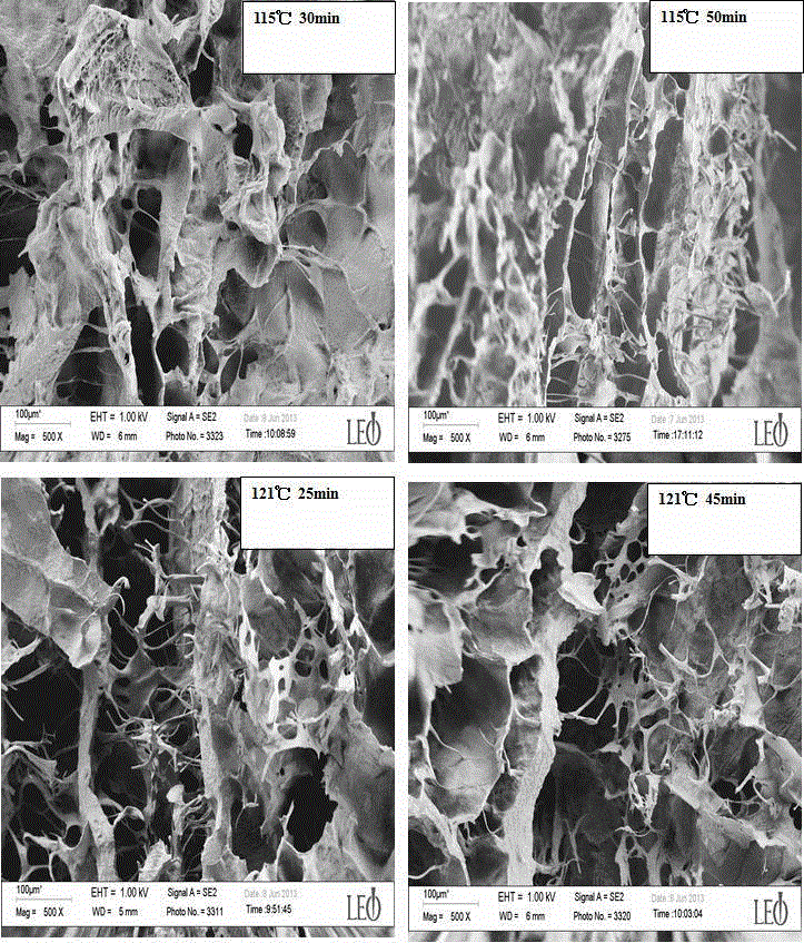 A tissue engineering scaffold suitable for the construction of human organs and its preparation method