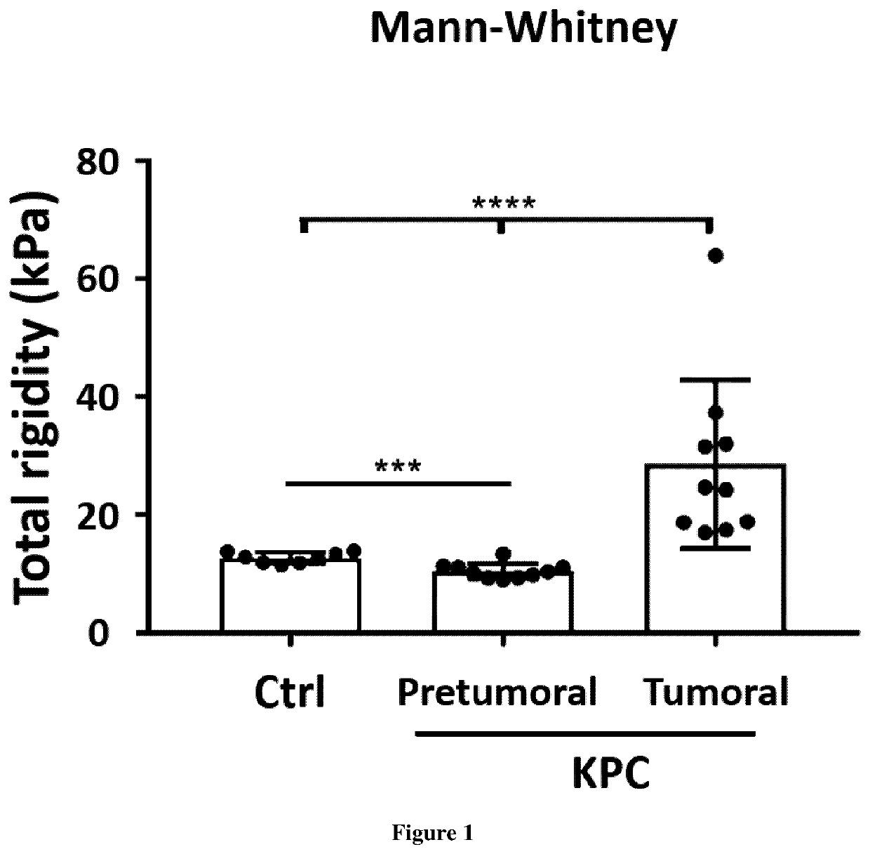 Use of ultrafast elasticity imaging for detecting pancreatic cancers