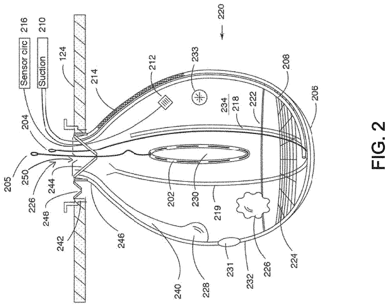 Laparoscopic workspace device