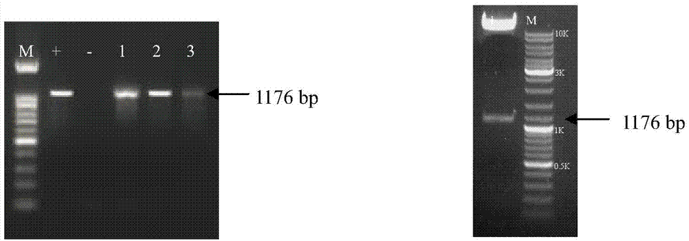 Trivalent HA-2HA1-LTB fusion expression vector of lotus corniculatus specifically-expressed H5N1 antigen protein