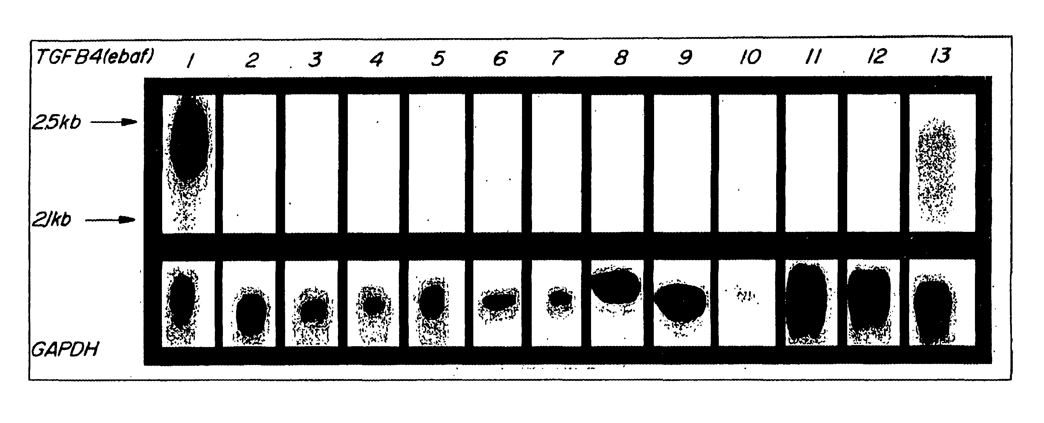 Method for diagnosing selected adenocarcinomas