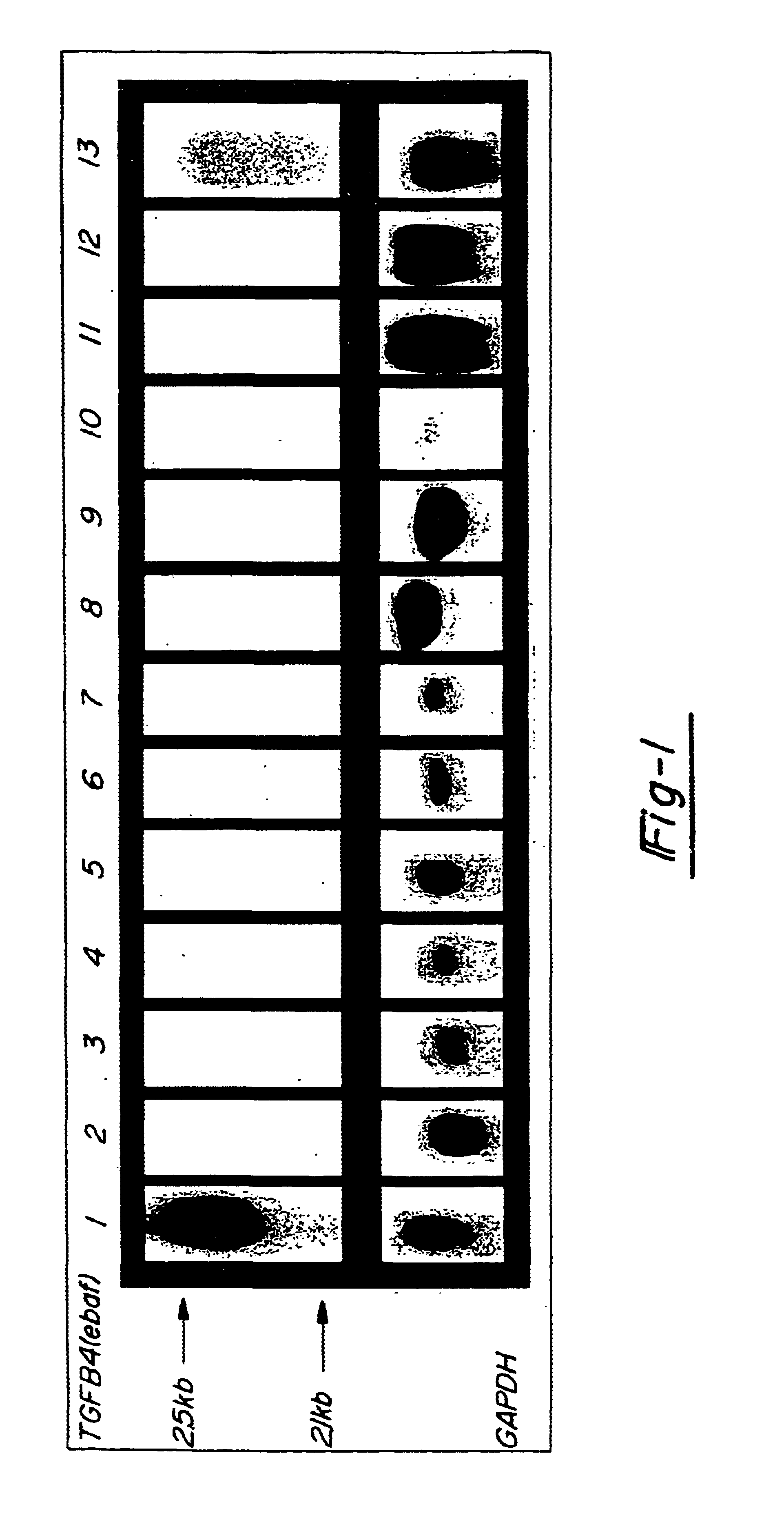 Method for diagnosing selected adenocarcinomas