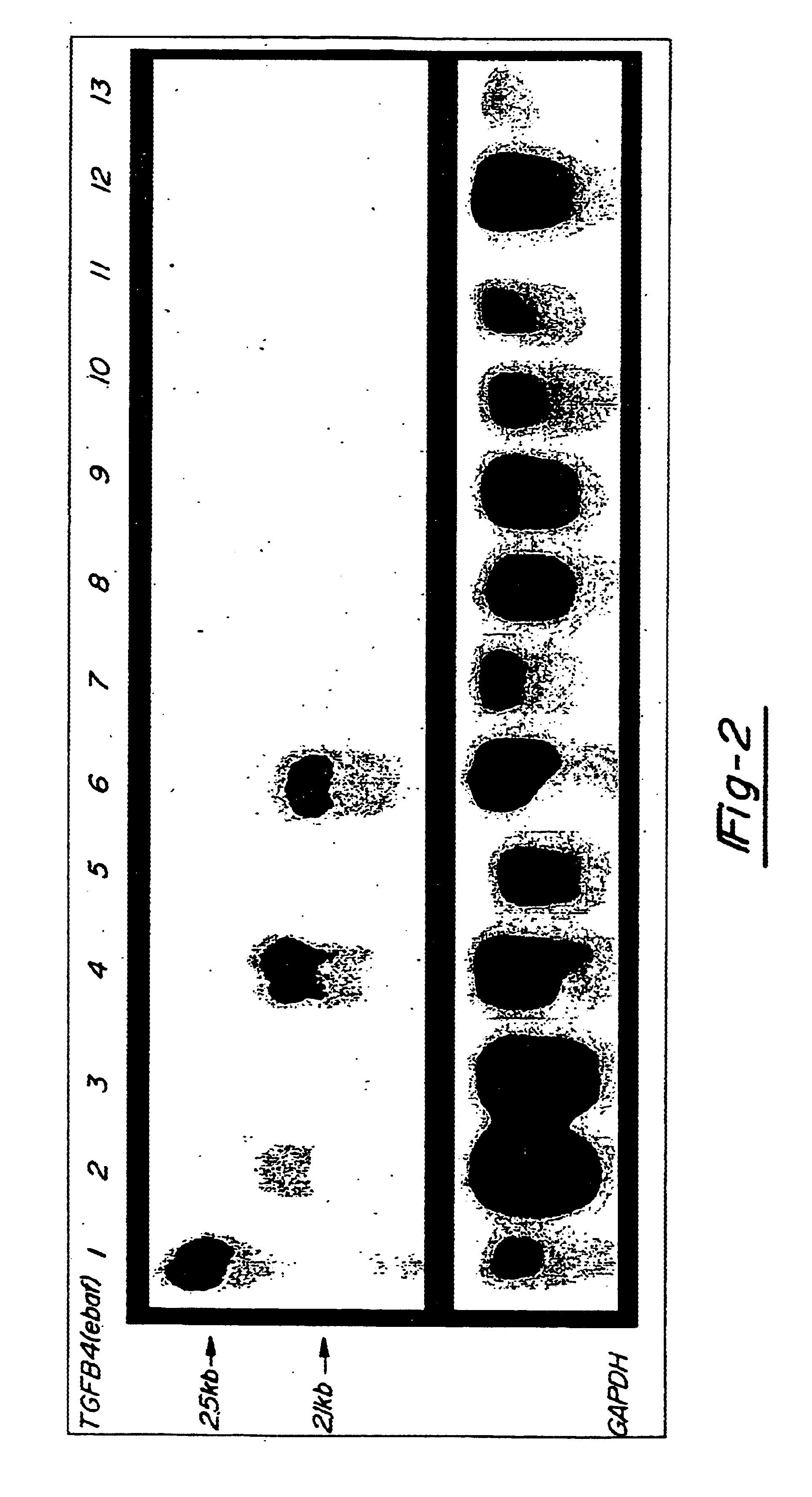 Method for diagnosing selected adenocarcinomas