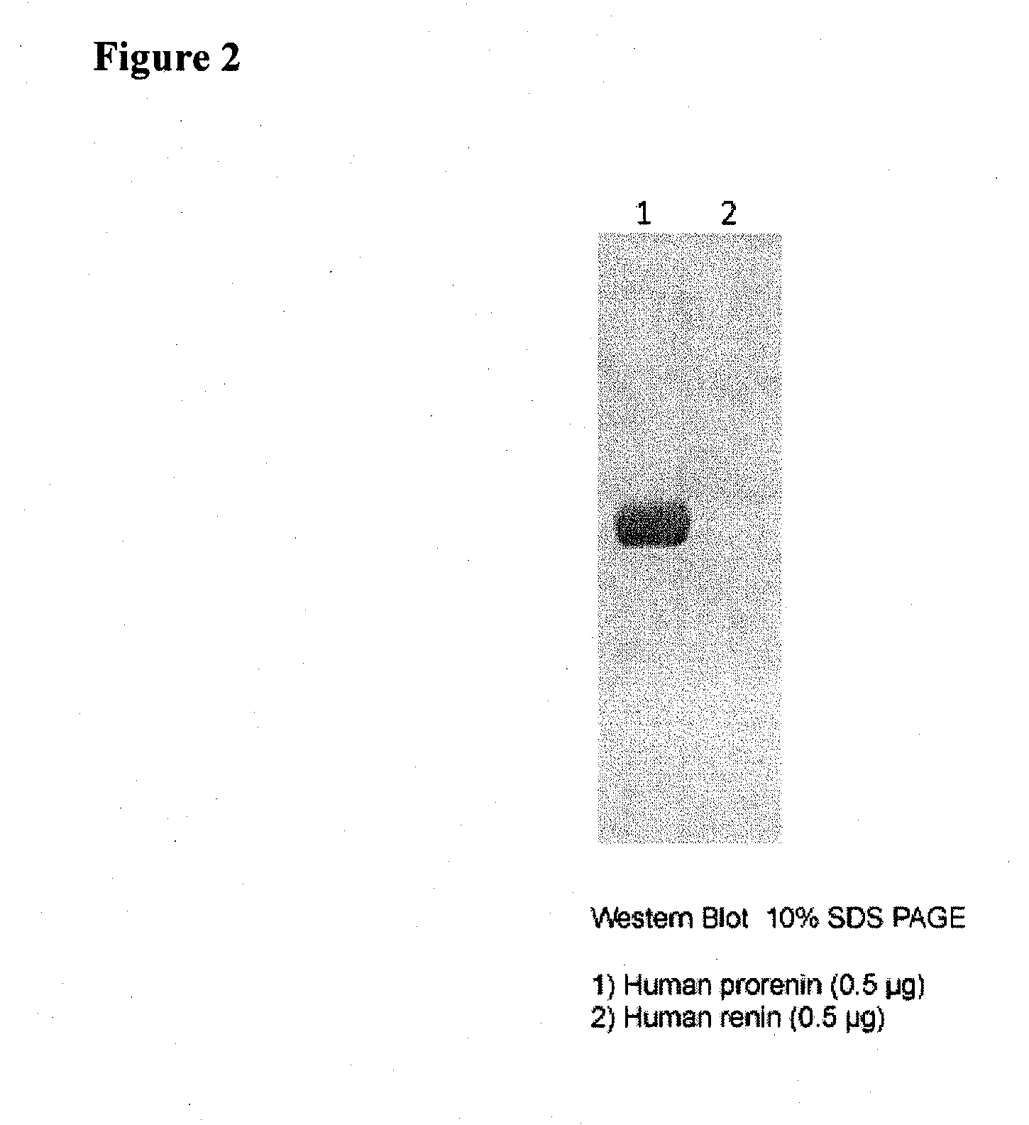 Methods For Screening Candidate Agents For Modulating Prorenin And Renin, Assays for Detecting Prorenin And Antibodies