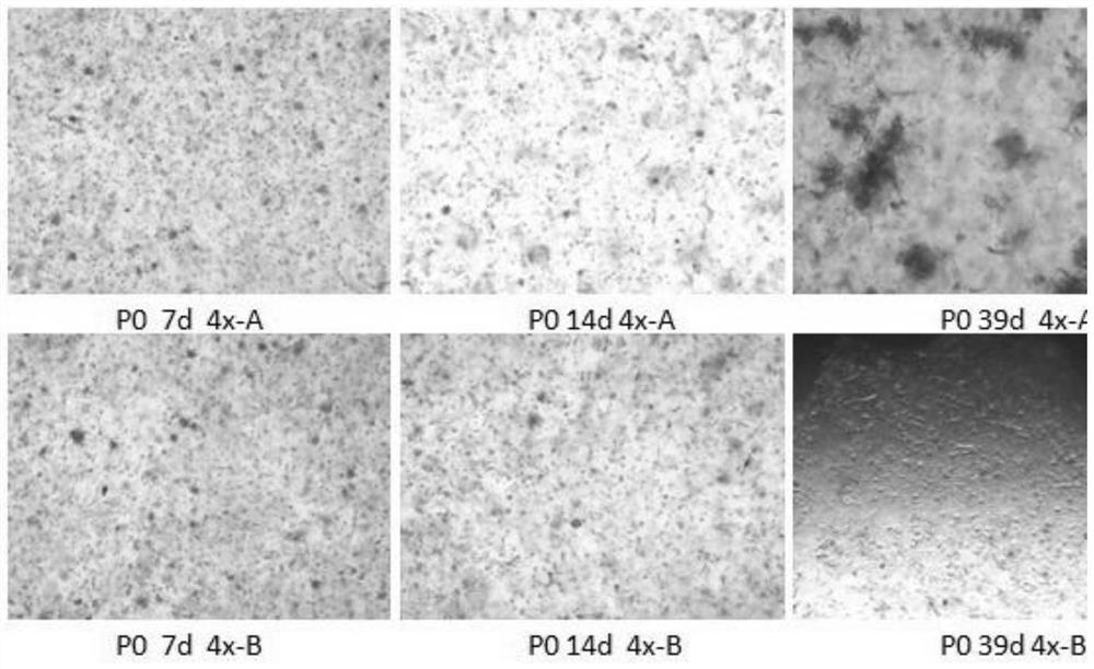 Culture method of osteosarcoma organ and bone tumor culture medium thereof