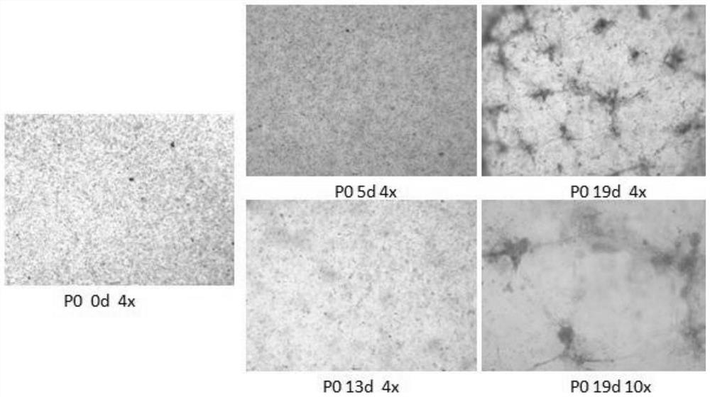 Culture method of osteosarcoma organ and bone tumor culture medium thereof