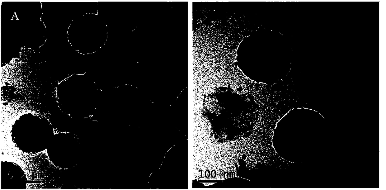 Chitosan nano particle with carbon dioxide and acid responsiveness and preparation method of aqueous dispersion of chitosan nano particle