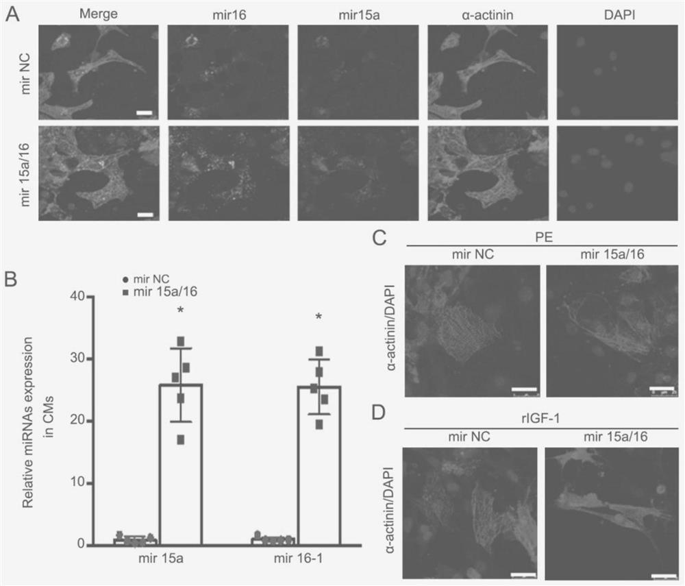 Application of miRNA in the treatment of cardiac hypertrophy