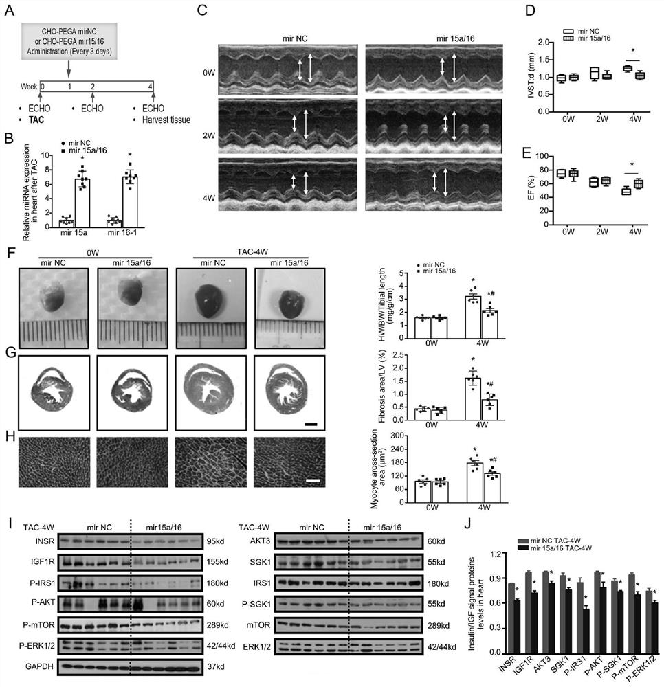 Application of miRNA in the treatment of cardiac hypertrophy